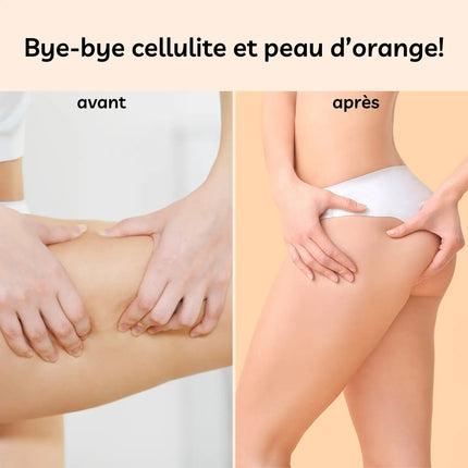 Voor-en-na resultaat van scrubhandschoen – vermindering van cellulite en sinaasappelhuid op de dijen