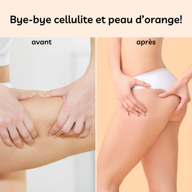 Voor-en-na resultaat van scrubhandschoen – vermindering van cellulite en sinaasappelhuid op de dijen
